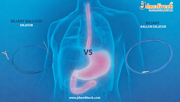 Biliary Dilator vs Balloon Dilator in ERCP